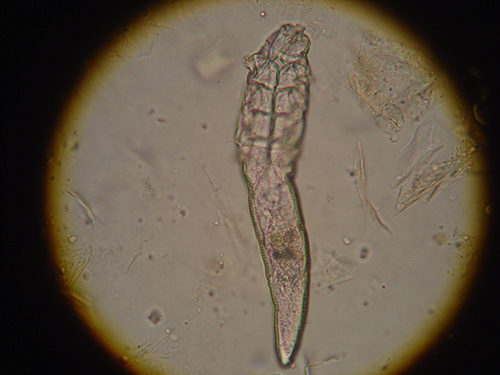 Demodex-2_edited